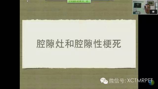 【PPT】脑小血管病影像与临床