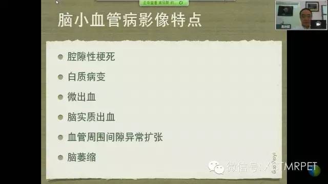 【PPT】脑小血管病影像与临床