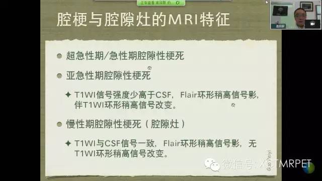 【PPT】脑小血管病影像与临床