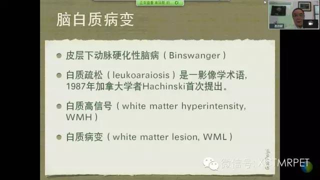 【PPT】脑小血管病影像与临床