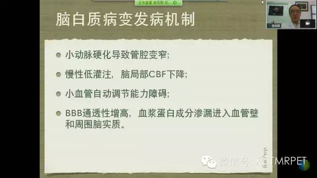 【PPT】脑小血管病影像与临床