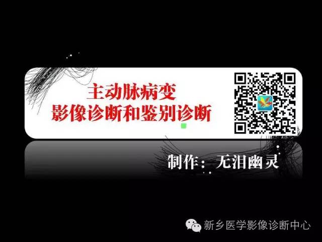 【PPT】主动脉病变影像诊断和鉴别诊断
