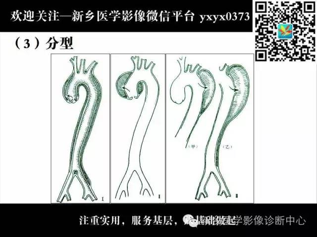 【PPT】主动脉病变影像诊断和鉴别诊断