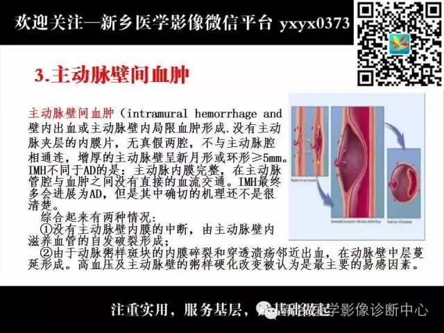 【PPT】主动脉病变影像诊断和鉴别诊断