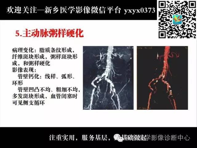 【PPT】主动脉病变影像诊断和鉴别诊断