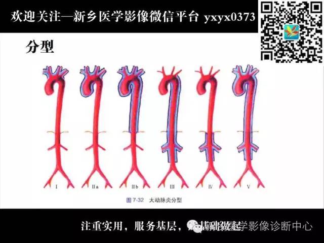 【PPT】主动脉病变影像诊断和鉴别诊断