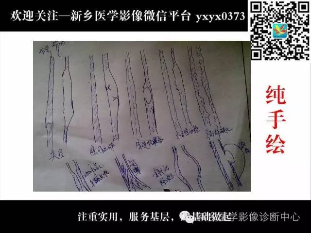 【PPT】主动脉病变影像诊断和鉴别诊断