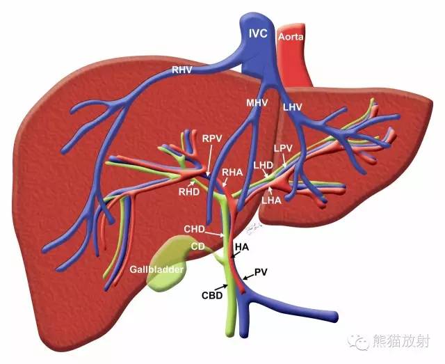 【病例】肝脏原发性淋巴瘤1例MR影像表现