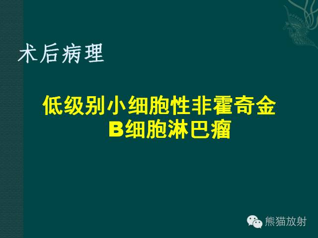 【病例】肝脏原发性淋巴瘤1例MR影像表现