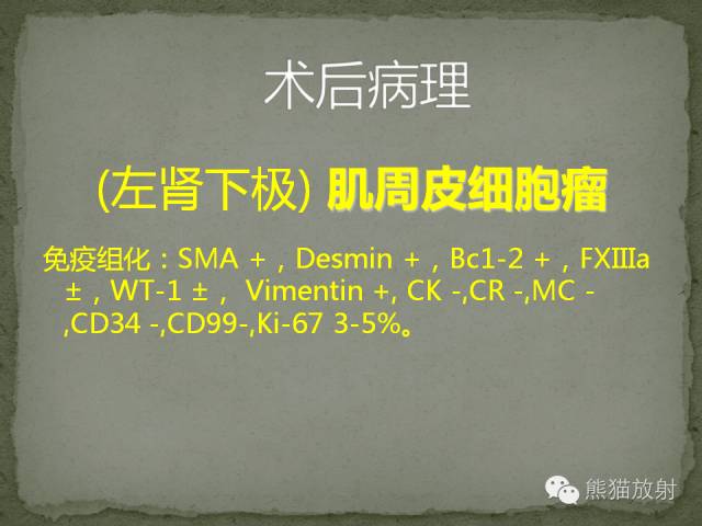 【病例】左肾下极血管周细胞瘤1例MR影像表现