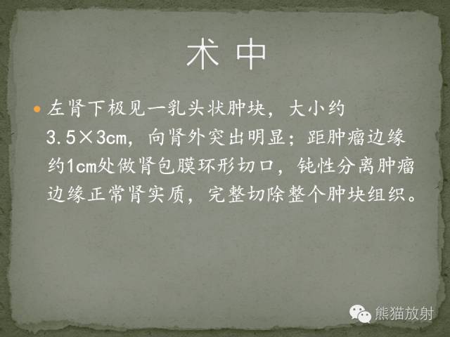 【病例】左肾下极血管周细胞瘤1例MR影像表现