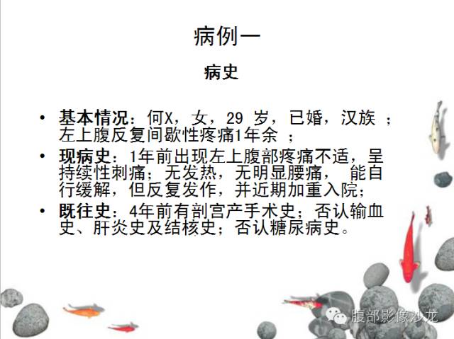 【病例】Castleman病2例CT影像表现 【病例】Castleman病2例CT影像表现