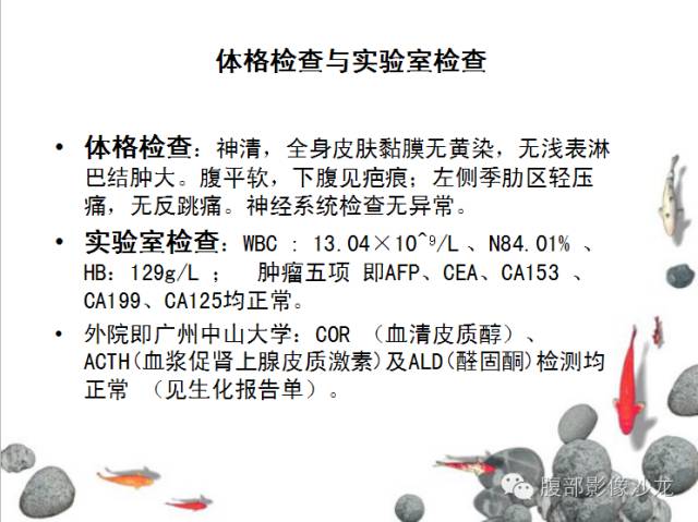 【病例】Castleman病2例CT影像表现 【病例】Castleman病2例CT影像表现