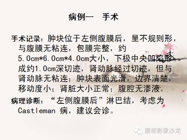 【病例】Castleman病2例CT影像表现 【病例】Castleman病2例CT影像表现