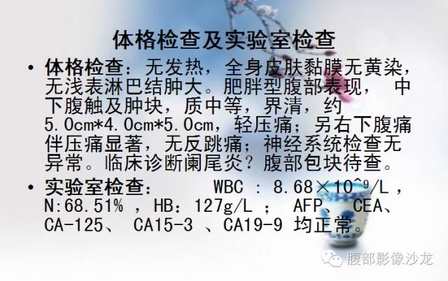 【病例】Castleman病2例CT影像表现 【病例】Castleman病2例CT影像表现