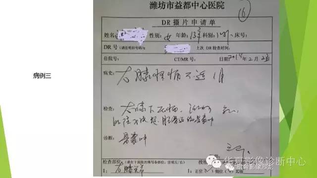 【病例】骨巨细胞瘤3例影像诊断与鉴别