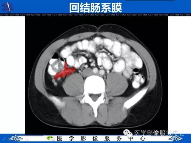 【PPT】盆腔解剖精要
