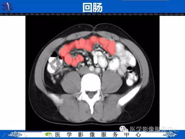 【PPT】盆腔解剖精要
