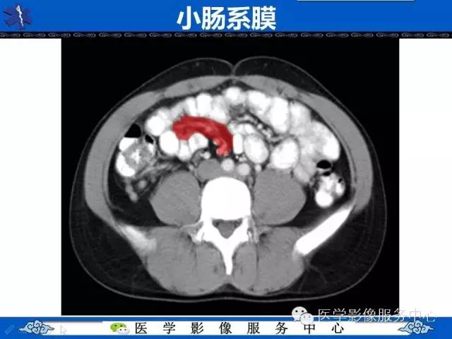 【PPT】盆腔解剖精要