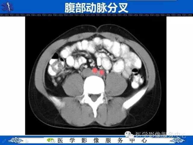 【PPT】盆腔解剖精要