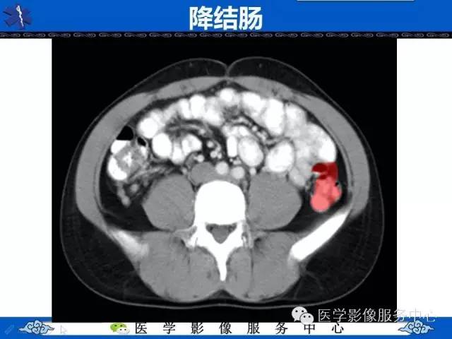 【PPT】盆腔解剖精要
