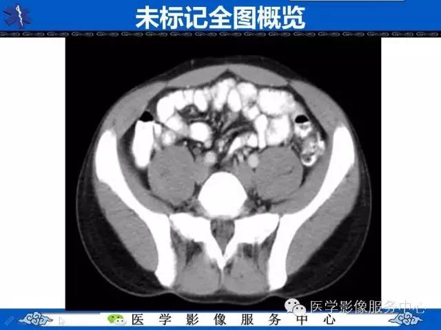 【PPT】盆腔解剖精要