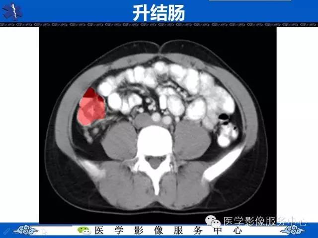 【PPT】盆腔解剖精要