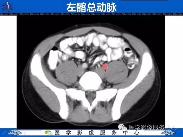 【PPT】盆腔解剖精要