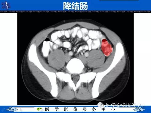 【PPT】盆腔解剖精要