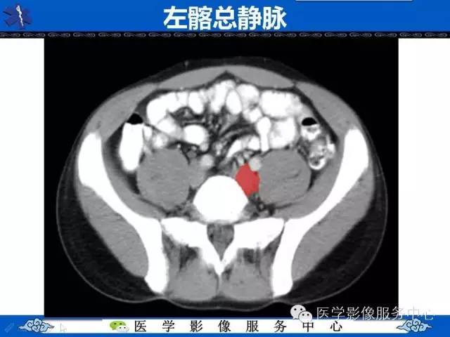 【PPT】盆腔解剖精要