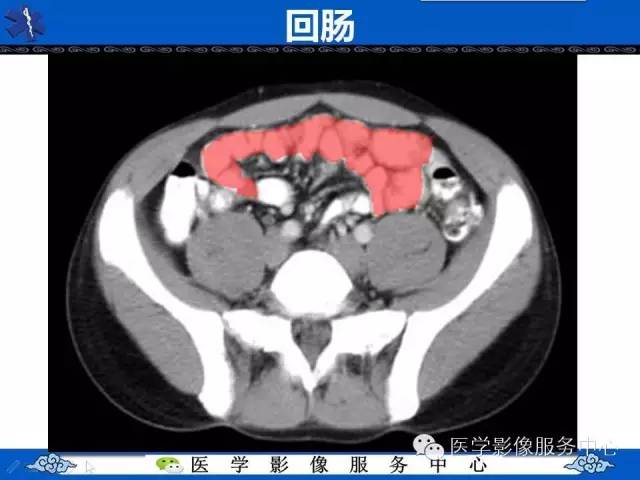 【PPT】盆腔解剖精要
