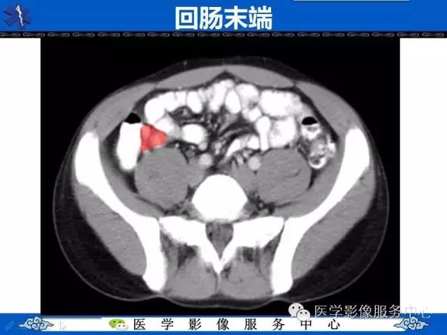 【PPT】盆腔解剖精要