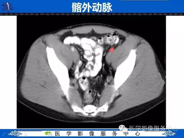 【PPT】盆腔解剖精要