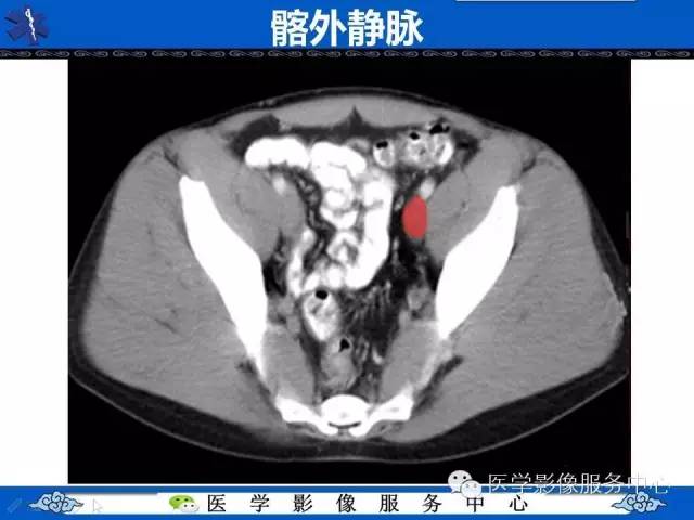 【PPT】盆腔解剖精要