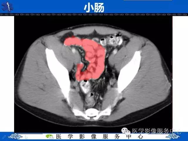 【PPT】盆腔解剖精要
