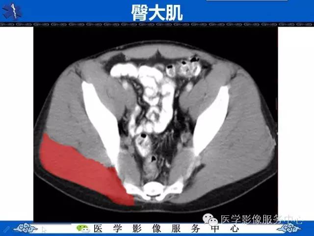 【PPT】盆腔解剖精要