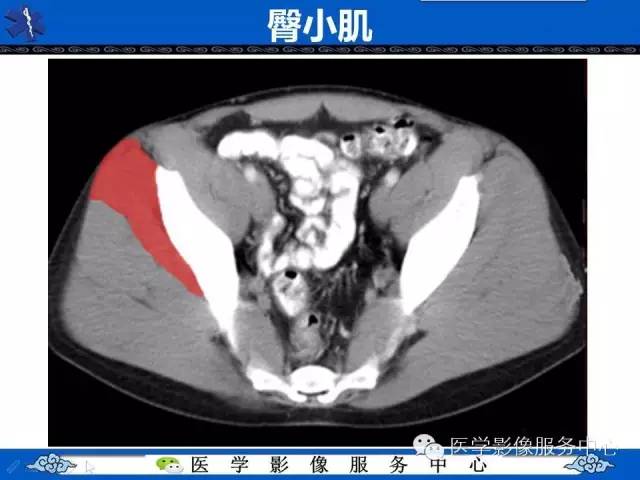 【PPT】盆腔解剖精要