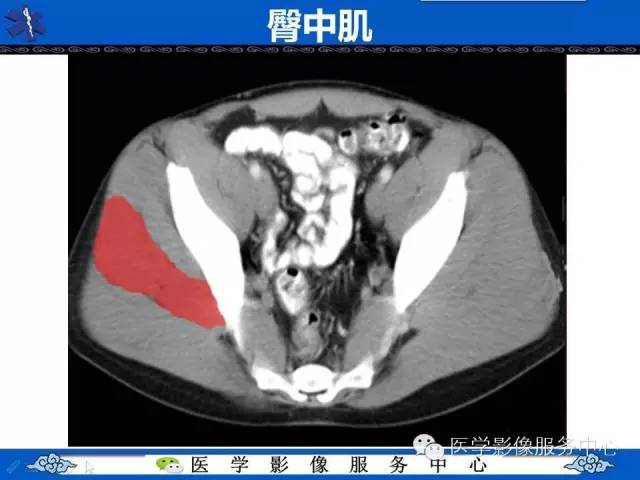 【PPT】盆腔解剖精要