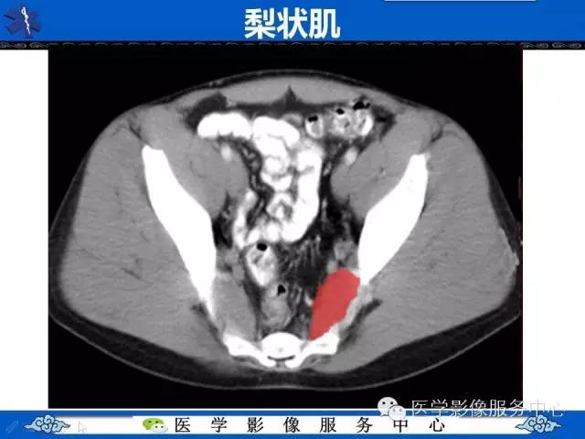 【PPT】盆腔解剖精要