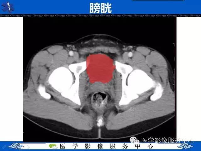 【PPT】盆腔解剖精要