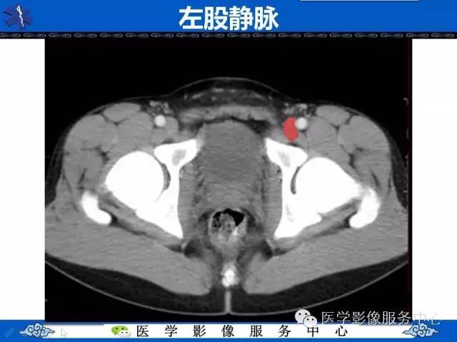 【PPT】盆腔解剖精要