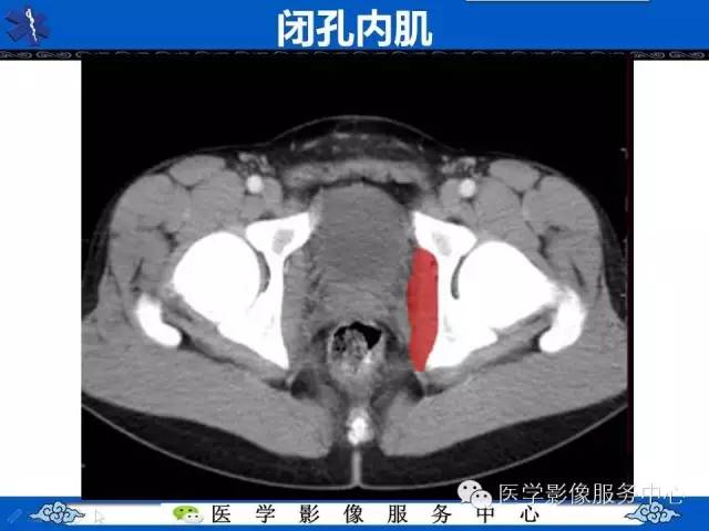 【PPT】盆腔解剖精要
