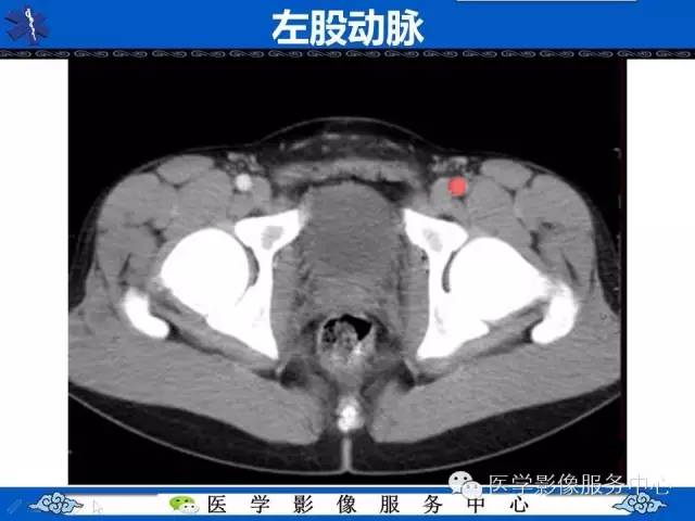 【PPT】盆腔解剖精要