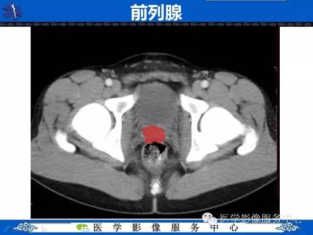 【PPT】盆腔解剖精要