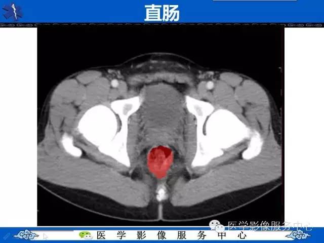 【PPT】盆腔解剖精要