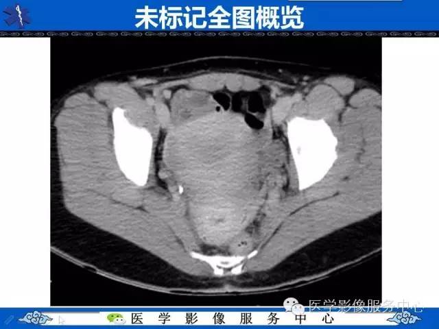 【PPT】盆腔解剖精要