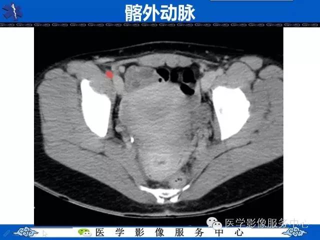 【PPT】盆腔解剖精要