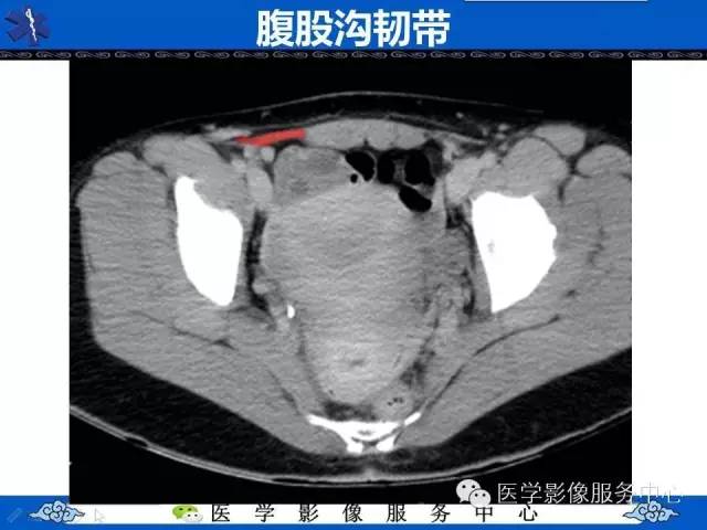 【PPT】盆腔解剖精要