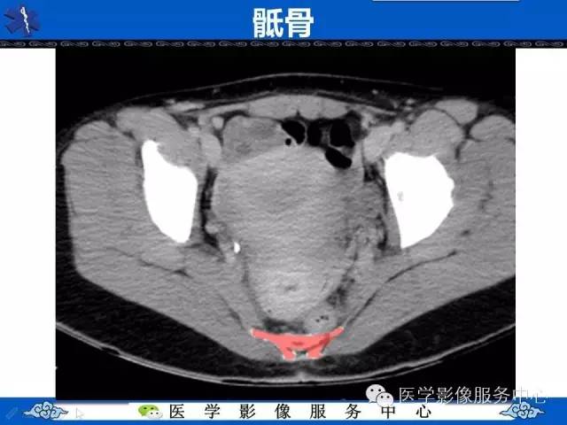 【PPT】盆腔解剖精要