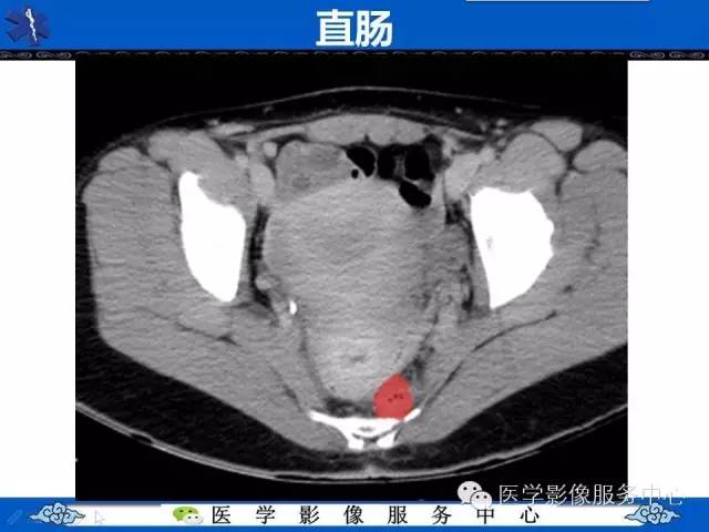 【PPT】盆腔解剖精要